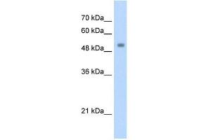 Transfected 293T; WB Suggested Anti-ZSCAN21 Antibody Titration: 1. (ZSCAN21 抗体  (C-Term))