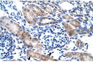 Immunohistochemistry (IHC) image for anti-Chloride Intracellular Channel 1 (CLIC1) (N-Term) antibody (ABIN2776130)