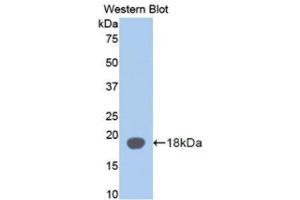 Western Blotting (WB) image for anti-alpha-2-Glycoprotein 1, Zinc-Binding (AZGP1) antibody (Biotin) (ABIN1171671) (AZGP1 抗体  (Biotin))