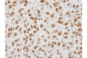 Immunohistochemistry (IHC) image for anti-Histone Deacetylase 1 (HDAC1) (C-Term) antibody (ABIN7448972) (HDAC1 抗体  (C-Term))