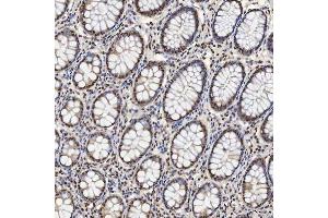 IHC analysis of U1A/SNRPA using anti-U1A/SNRPA antibody (ABIN7600891). (SNRPA1 抗体  (AA 25-218))