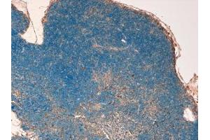 Immunohistochemistry (IHC) image for anti-Signal Transducer and Activator of Transcription 3 (Acute-Phase Response Factor) (STAT3) (C-Term) antibody (ABIN184593)