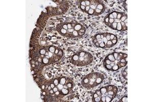 Immunohistochemical staining of human rectum with DSCR3 polyclonal antibody  shows strong cytoplasmic positivity in granular pattern in glandular cells. (DSCR3 抗体)