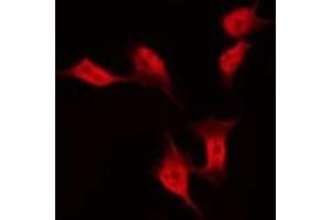 ABIN6275403 staining Hela by IF/ICC. (FAM35A 抗体  (Internal Region))