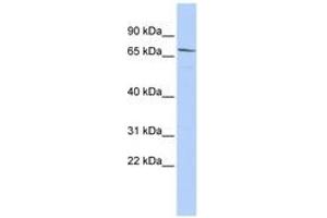 Image no. 1 for anti-Maternal Embryonic Leucine Zipper Kinase (MELK) (AA 432-481) antibody (ABIN6743416) (MELK 抗体  (AA 432-481))