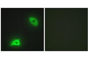 Immunofluorescence analysis of HeLa cells, using DUSP6 antibody. (DUSP6 抗体  (Internal Region))