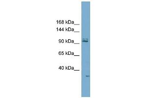 WB Suggested Anti-RC3H2 Antibody Titration:  0. (RC3H2 抗体  (Middle Region))