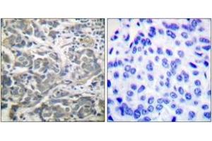 Immunohistochemistry (IHC) image for anti-SNF1A/AMP-Activated Protein Kinase (SNF1A) (AA 140-189) antibody (ABIN2888561) (AMPK alpha 抗体  (AA 140-189))
