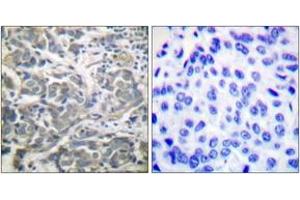Immunohistochemistry (IHC) image for anti-SNF1A/AMP-Activated Protein Kinase (SNF1A) (AA 140-189) antibody (ABIN2888561) (AMPK alpha 抗体  (AA 140-189))