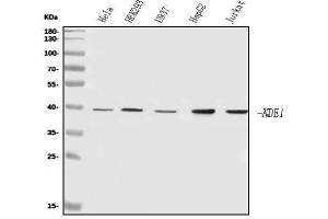Western blot analysis of NDE1 using anti-NDE1 antibody (ABIN7602401).