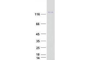 Western Blotting (WB) image for Hephaestin (HEPH) (Transcript Variant 1) protein (Myc-DYKDDDDK Tag) (ABIN2722635)