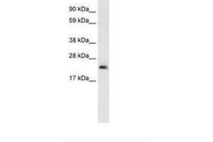 Image no. 1 for anti-High Mobility Group Box 3 (HMGB3) (N-Term) antibody (ABIN202056) (HMGB3 抗体  (N-Term))