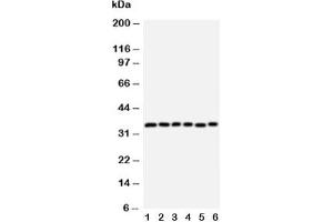 Western blot testing of Aquaporin 4 antibody and Lane 1:  rat heart;  2: rat brain;  3: rat kidney;  4: (h) HT1080;  5: (h) MCF-7;  6: (h) COLO320 cell lysate (Aquaporin 4 抗体  (AA 258-27))