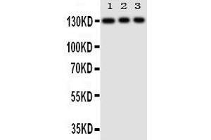 Anti-TLR10 antibody, Western blotting Lane 1: HELA Cell Lysate Lane 2: JURKAT Cell Lysate Lane 3: CEMJ Cell Lysate (TLR10 抗体  (N-Term))