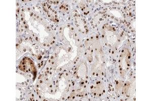 ABIN6267582 at 1/200 staining human kidney tissue sections by IHC-P. (NFKB2 抗体  (pSer866))
