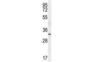 TTF1 antibody western blot analysis in HeLa lysate. (NKX2-1 抗体  (AA 2-1))