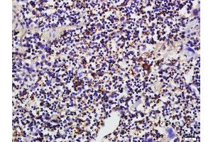 Immunohistochemistry (Paraffin-embedded Sections) (IHC (p)) image for anti-CD19 Molecule (CD19) (AA 151-250) antibody (ABIN1387313)