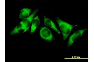 Immunofluorescence of purified MaxPab antibody to ACSL3 on HeLa cell. (Acsl3 抗体  (AA 1-720))