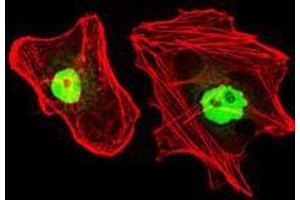 Immunofluorescence analysis of HeLa cells using RPA1 mouse mAb (green). (RPA1 抗体)