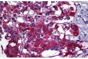 Human Adrenal: Formalin-Fixed, Paraffin-Embedded (FFPE) (PIM1 抗体  (AA 1-314))