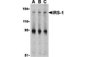 Western Blotting (WB) image for anti-Insulin Receptor Substrate 1 (IRS1) (Middle Region) antibody (ABIN1030966) (IRS1 抗体  (Middle Region))