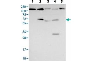 Western blot analysis of Lane 1: RT-4, Lane 2: U-251 MG, Lane 3: Human Plasma, Lane 4: Liver, Lane 5: Tonsil with FAM169A polyclonal antibody  at 1:250-1:500 dilution. (FAM169A 抗体)