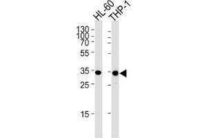 Western Blotting (WB) image for anti-Malate Dehydrogenase 1, NAD (Soluble) (MDH1) antibody (ABIN3001705) (MDH1 抗体)