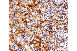 Immunohistochemical analysis of paraffin-embedded human tonsil using FYN antibody at 1:25 dilution. (FYN 抗体)