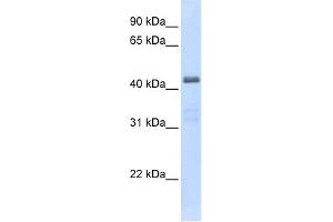 Western Blotting (WB) image for anti-Solute Carrier Family 29 (Nucleoside Transporters), Member 2 (SLC29A2) (C-Term) antibody (ABIN2781572)