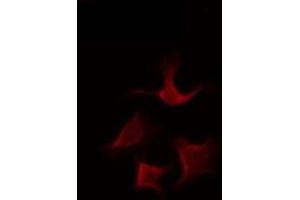 ABIN6275657 staining Hela by IF/ICC. (USP43 抗体  (N-Term))