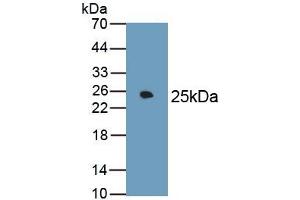 Detection of Recombinant FN, Rat using Monoclonal Antibody to Fibronectin (FN) (Fibronectin 抗体  (AA 355-558))