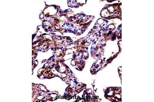 Immunohistochemistry (IHC) image for anti-Fibulin 1 (FBLN1) antibody (ABIN2998151) (Fibulin 1 抗体)