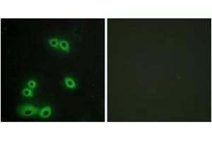 Immunofluorescence analysis of A549 cells, using MUC1 Antibody. (MUC1 抗体  (AA 1191-1240))