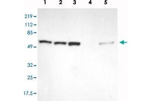 Western blot analysis of Lane 1: RT-4, Lane 2: U-251 MG, Lane 3: A-431, Lane 4: Liver, Lane 5: Tonsil with GPKOW polyclonal antibody  at 1:250-1:500 dilution. (GPKOW 抗体)