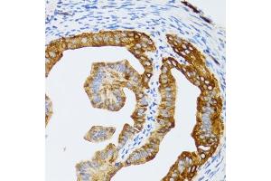 Immunohistochemistry of paraffin-embedded rat fallopian tube using p60 C antibody  at dilution of 1:100 (40x lens). (CHAF1B 抗体  (AA 270-559))