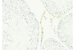 ABIN6276786 at 1/100 staining Mouse testis tissue by IHC-P. (Cathelicidin 抗体  (Internal Region))