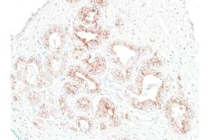 Immunohistochemistry (IHC) image for anti-CD276 (CD276) (C-Term) antibody (ABIN7455195)