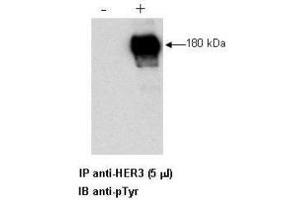 Combined immunoprecipitation and western blot of a human cell lysate using anti-HER3 antibody. (ERBB3 抗体  (C-Term))