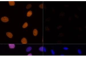 Immunofluorescence analysis of U-2 OS cells using Acetyl-Histone H4-K16 Polyclonal Antibody at dilution of 1:100.