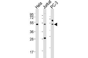 All lanes : Anti-NFKBIE Antibody (Center) at 1:2000 dilution Lane 1: Hela whole cell lysates Lane 2: Jurkat whole cell lysates Lane 3: PC-3 whole cell lysates Lysates/proteins at 20 μg per lane.
