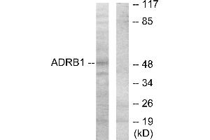 Western blot analysis of extracts from HT-29 cells, using ADRB1 antibody. (ADRB1 抗体)