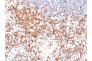 Formalin-fixed, paraffin-embedded human Lymph Node stained with CD27 Rabbit Recombinant Monoclonal Antibody (LPFS2/2034R). (Recombinant CD27 抗体)