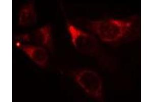 ABIN6275540 staining NIH-3T3 cells by IF/ICC. (TAO Kinase 1 (TAOK1) (Internal Region) 抗体)