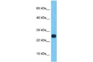 Host:  Rabbit  Target Name:  SSX2B  Sample Type:  Thyroid Tumor lysates  Antibody Dilution:  1. (Synovial Sarcoma, X Breakpoint 2B (SSX2B) (N-Term) 抗体)