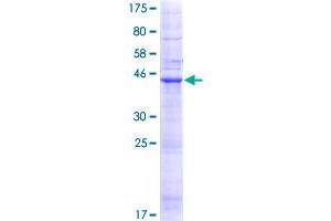 LHFP Protein (AA 1-200) (GST tag)