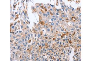Immunohistochemistry (IHC) image for anti-Neuregulin 4 (NRG4) antibody (ABIN2828341) (Neuregulin 4 抗体)