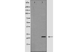 Western blot analysis of MGMT expression in Jurkat cells. (MGMT 抗体  (N-Term))