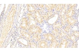 Immunohistochemistry (IHC) image for anti-Lysyl Oxidase-Like 3 (LOXL3) (AA 519-726) antibody (ABIN7439198)