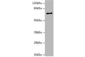 Western blot All lanes: HNRNPM antibody at 2 μg/mL + NIH/3T3 whole cell lysate Secondary Goat polyclonal to rabbit IgG at 1/10000 dilution Predicted band size: 78, 74 kDa Observed band size: 78 kDa (HNRNPM 抗体  (AA 491-730))
