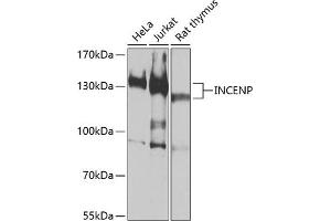 Western blot analysis of extracts of various cell lines, using INCENP antibody (ABIN6130494, ABIN6142441, ABIN6142442 and ABIN6213904) at 1:1000 dilution. (INCENP 抗体  (AA 785-914))